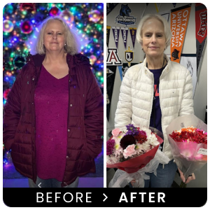 LifeRx before and after